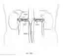 Fig. 28 - Energetic modulation of nerves