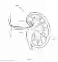 Fig. 48 - Energetic modulation of nerves