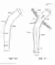 Fig. 12 - METHODS AND SYSTEMS FOR ABLATING TISSUE