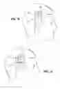 Fig. 04 - Post mountable BAHA bandage device