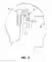 Fig. 06 - Post mountable BAHA bandage device