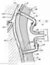 Fig. 01 - Systems, methods and devices for circulatory access
