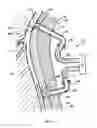 Fig. 02 - Systems, methods and devices for circulatory access