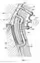 Fig. 06 - Systems, methods and devices for circulatory access