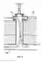 Fig. 11 - Systems, methods and devices for circulatory access