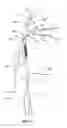 Fig. 13 - Systems, methods and devices for circulatory access
