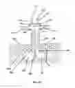 Fig. 19 - Systems, methods and devices for circulatory access