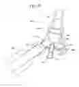 Fig. 56 - Systems, methods and devices for circulatory access