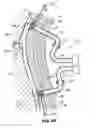 Fig. 64 - Systems, methods and devices for circulatory access