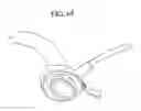 Fig. 66 - Systems, methods and devices for circulatory access