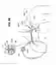Fig. 67 - Systems, methods and devices for circulatory access