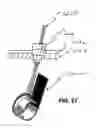 Fig. 68 - Systems, methods and devices for circulatory access