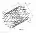 Fig. 07 - Intestinal sleeve