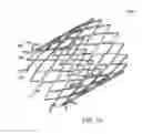 Fig. 11 - Intestinal sleeve