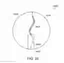 Fig. 42 - Intestinal sleeve