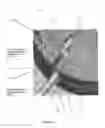 Fig. 03 - Medical Apparatus