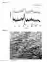 Fig. 03 - Calciumphosphate-based nanoparticles as carrier-systems for photodynamic therapy