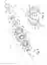 Fig. 04 - Intravascular valve component with improved valve positioning