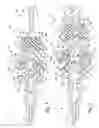 Fig. 05 - Intravascular valve component with improved valve positioning