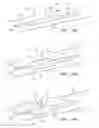Fig. 22 - Shapeable or Steerable Guide Sheaths and Methods for Making and Using Them