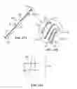 Fig. 35 - Shapeable or Steerable Guide Sheaths and Methods for Making and Using Them