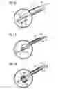 Fig. 14 - Stimulation of penis erection