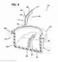 Fig. 10 - Trocar seal with reduced contact area