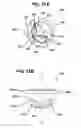 Fig. 12 - Trocar seal with reduced contact area