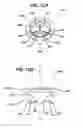Fig. 13 - Trocar seal with reduced contact area