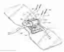 Fig. 01 - SECUREMENT DEVICE FOR INDWELLING CATHETERS OR INTRODUCERS