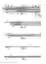 Fig. 02 - Device and method for inserting a cardiac catheter
