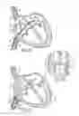 Fig. 09 - Device and method for inserting a cardiac catheter