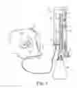 Fig. 02 - ACCELEROMETER BASED LASER LEVELING DEVICE