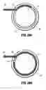 Fig. 50 - Moisture-detecting shaft for use with an electro-mechanical surgical device