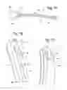 Fig. 06 - APPARATUS AND METHOD FOR REGULATING TISSUE WELDER JAWS