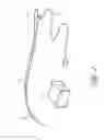 Fig. 02 - SYSTEMS AND METHODS FOR TREATING A HOLLOW ANATOMICAL STRUCTURE