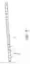 Fig. 09 - SYSTEMS AND METHODS FOR TREATING A HOLLOW ANATOMICAL STRUCTURE