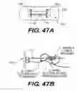 Fig. 45 - Methods and devices for spinal disc annulus reconstruction and repair