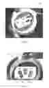 Fig. 11 - Method for preparing a patient for a medical treatment