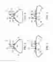 Fig. 04 - Bedridden patient transfer gurney