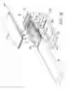 Fig. 06 - Pulmonary mattress
