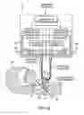 Fig. 02 - VENTILATING APPARATUS AND METHOD ENABLING A PATIENT TO TALK WITH OR WITHOUT A TRACHOSTOMY TUBE CHECK VALVE