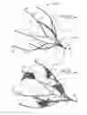 Fig. 03 - Fallopian Tube Occlusion Device