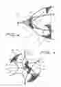 Fig. 04 - Fallopian Tube Occlusion Device