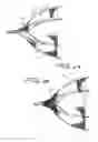 Fig. 10 - Fallopian Tube Occlusion Device