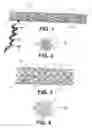 Fig. 02 - Methods and apparatus for occluding reproductive tracts to effect contraception
