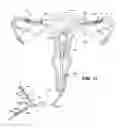 Fig. 08 - Methods and apparatus for occluding reproductive tracts to effect contraception