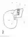 Fig. 02 - Device for the alleviation of snoring and sleep apnoea