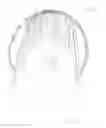Fig. 01 - Headband with bangs
