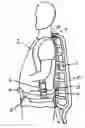 Fig. 01 - Tree stand and gear carrying system